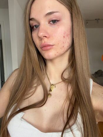 gld.melina