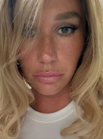 Kesha