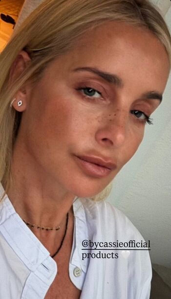 Leaked Louise redknapp private photo viral onlyfans