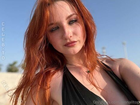 Lynnalltop