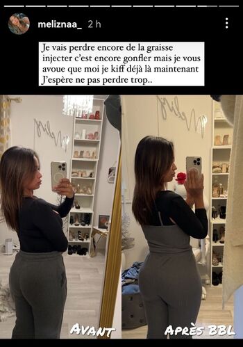 Leaked Meliznaa private photo viral onlyfans