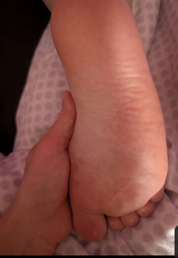 Plantes De Pieds Candid