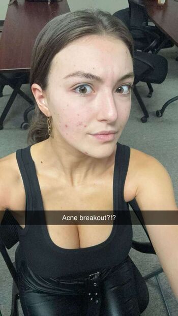 Leaked Rachel michelle private photo viral onlyfans