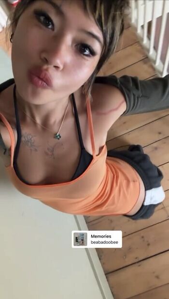 Radvxz