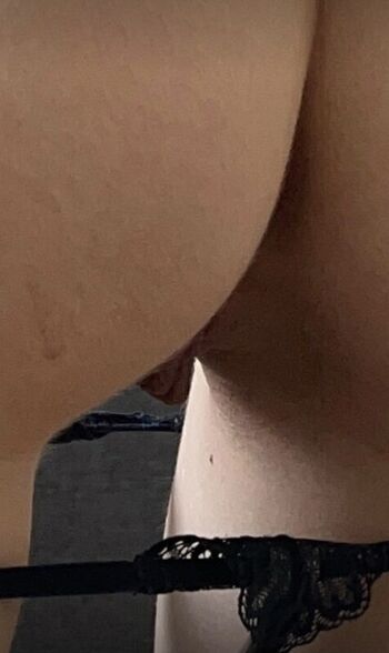 Skinnynass