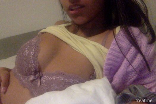 Leaked Treatme page private photo viral onlyfans