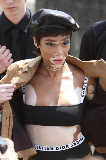 Winnie Harlow