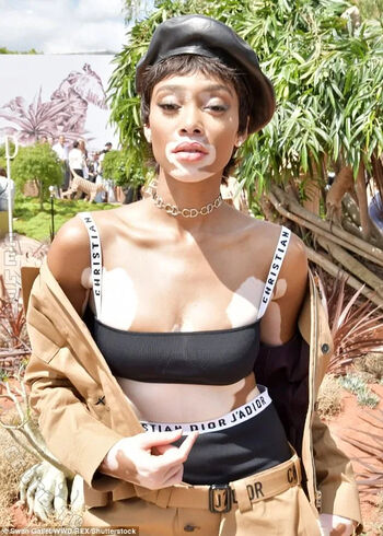 Winnie Harlow
