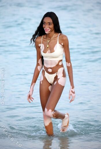 Winnie Harlow