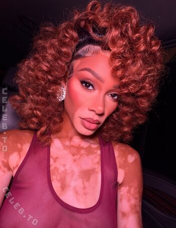 Winnie Harlow