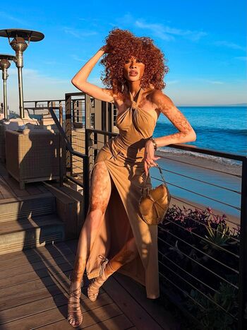 Winnie Harlow